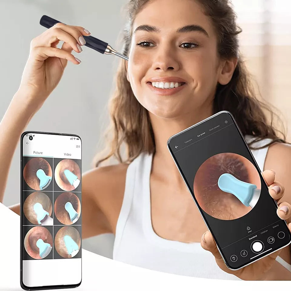 Ear Wax cleaner with LED Light-Scoop Tool with Camera/Records video or takes pictures