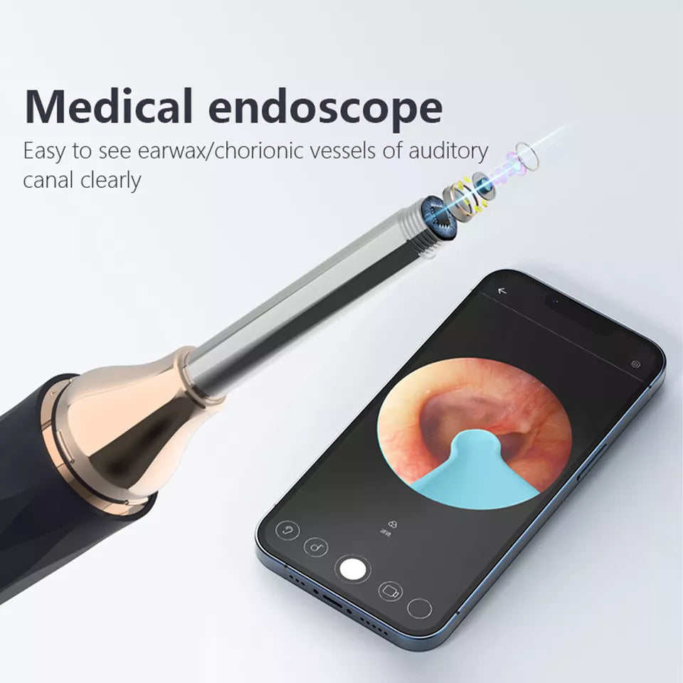 Ear Wax cleaner with LED Light-Scoop Tool with Camera/Records video or takes pictures